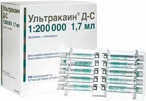 Ультракаин Д-С 1:200 000 - 100 карпул по 1.7 мл (Sanofi Aventis)